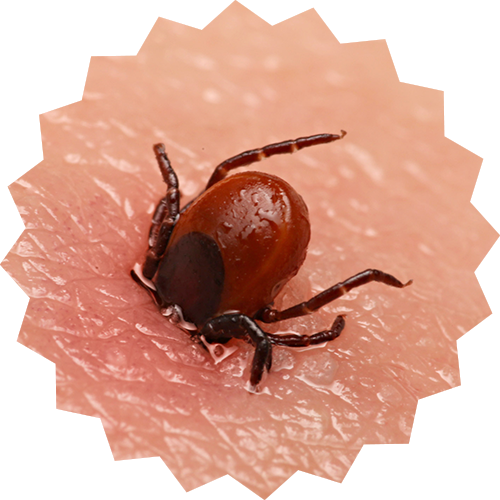 Tick Bites